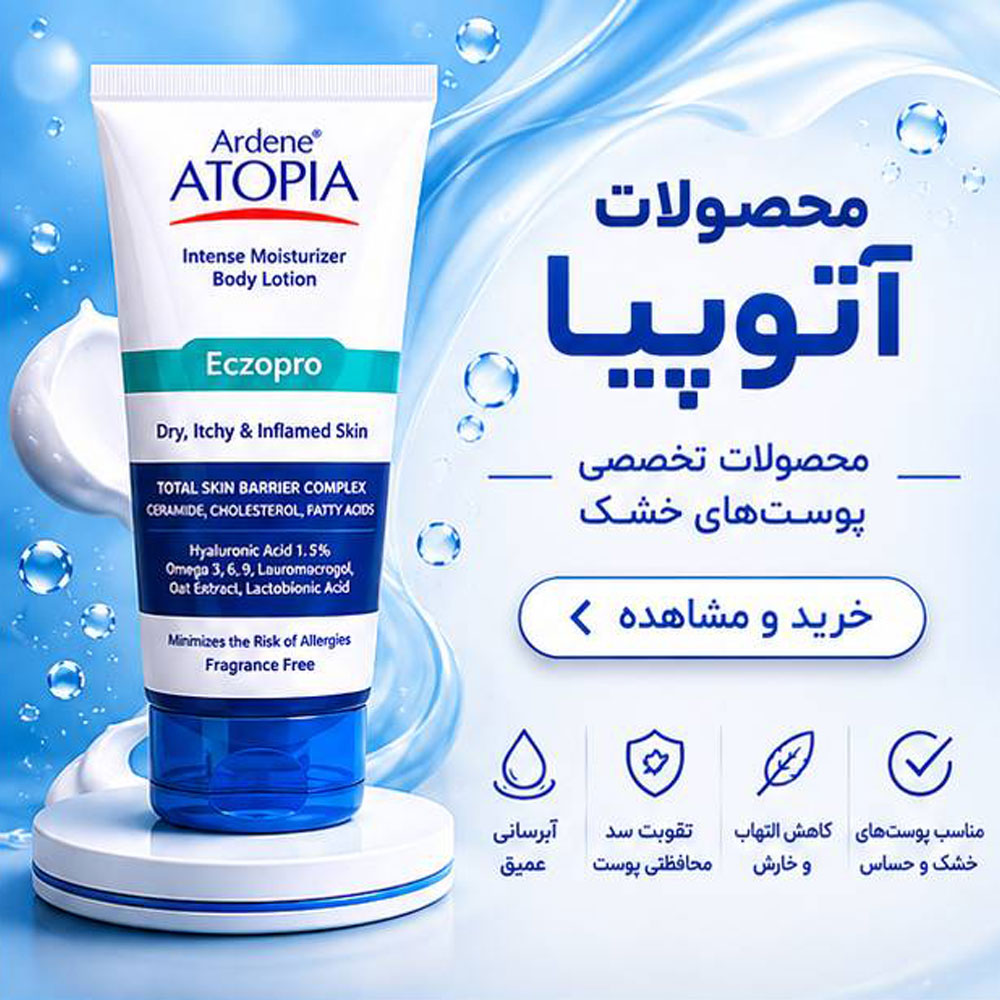 محصولات آتوپیا